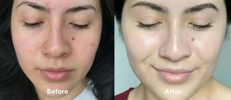 Before After