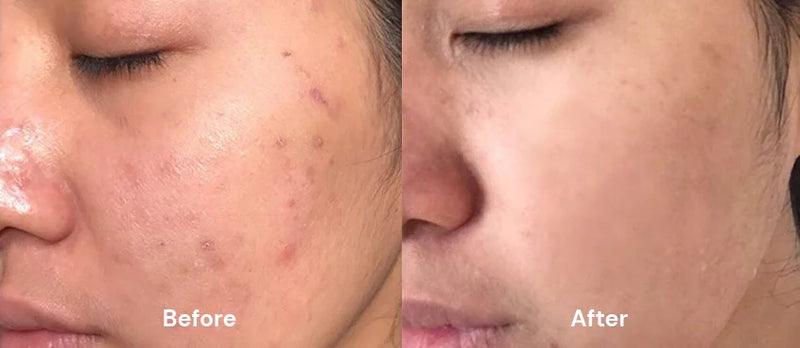 Before After