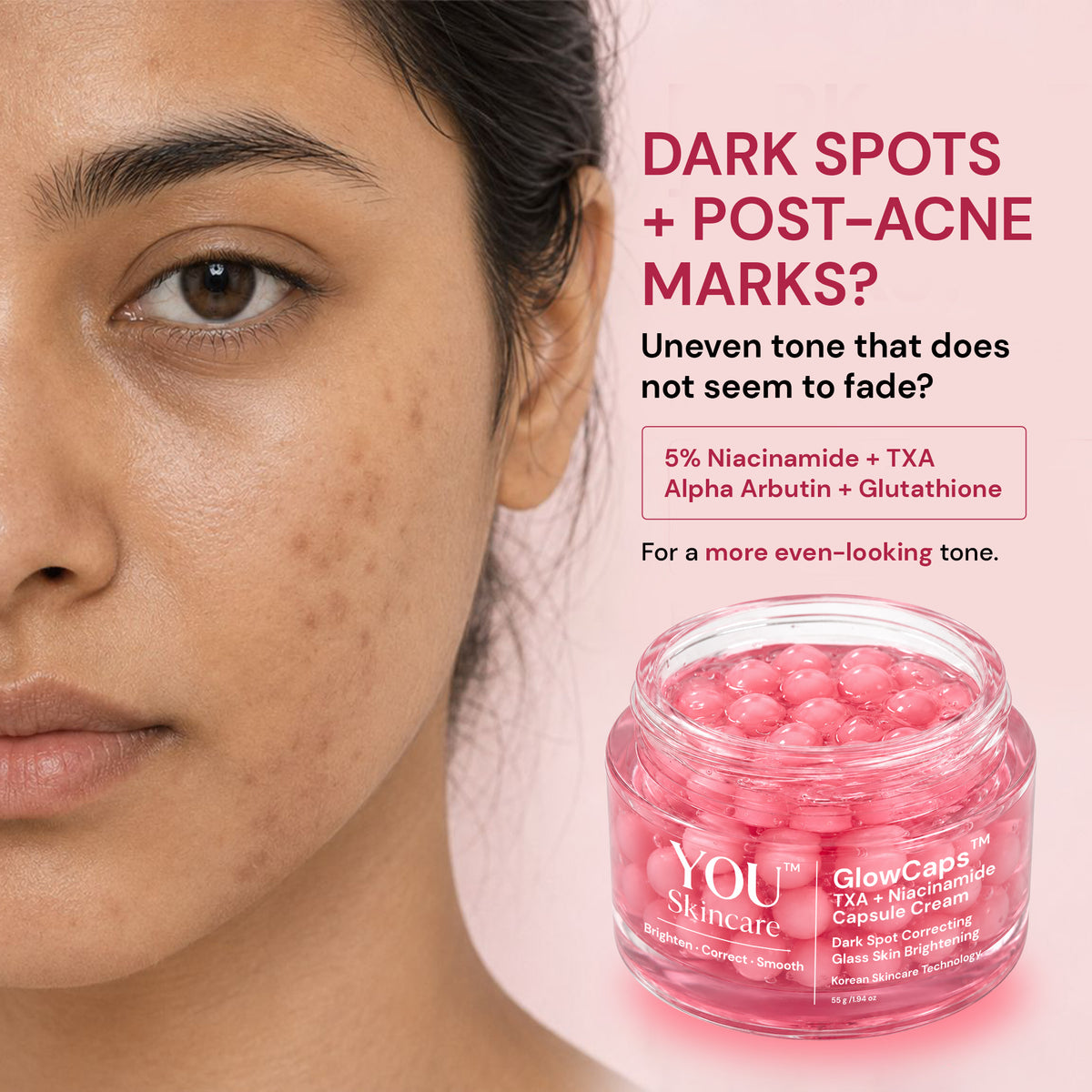 Close-up of a woman's face with acne marks next to a jar of You Skincare GlowCap 5ml Dark Spot Capsules on a pink background with promotional text.