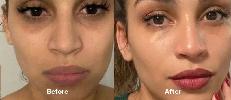 Before After