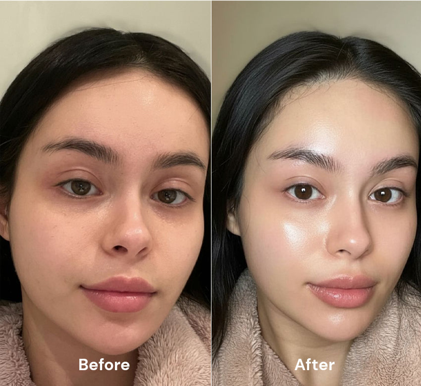 Before After