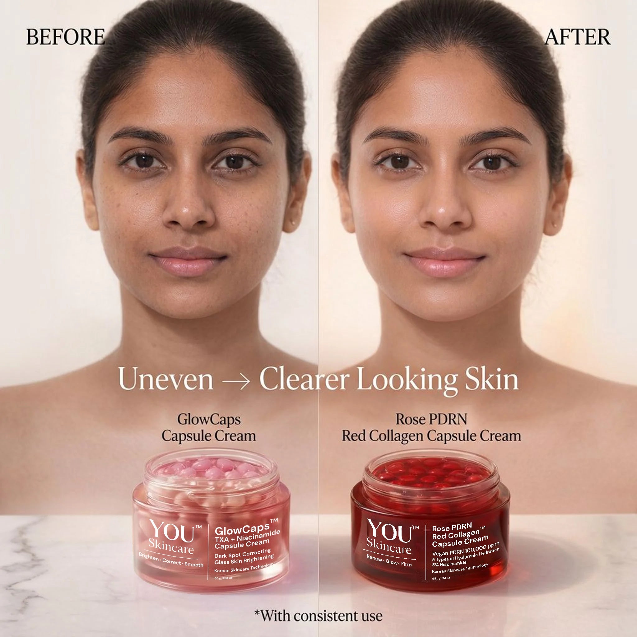 Before and after comparison of skin with products from YOU Skincare on a neutral background.