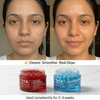 Before and after comparison of a woman's face with You Skincare products shown below.