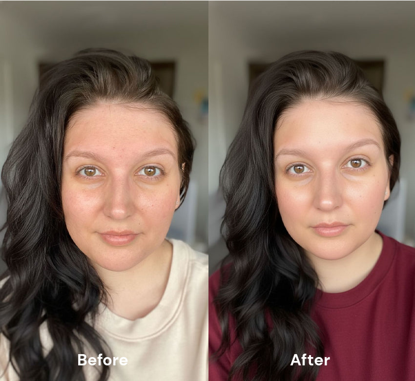 Before After